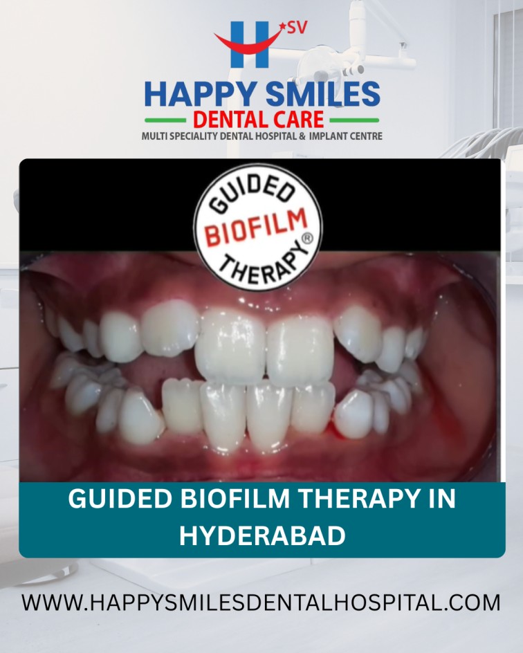 Affordable Guided Biofilm Therapy Cost in Hyderabad