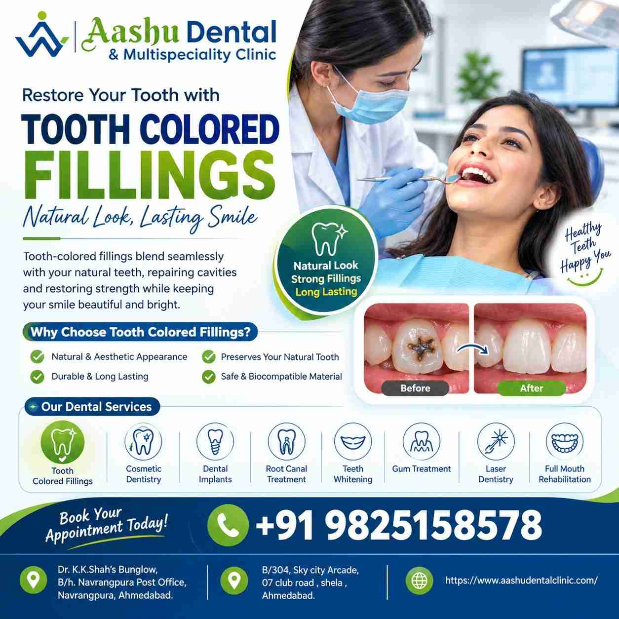Restore Damaged Teeth with Tooth Colored Fillings in Ahmedabad