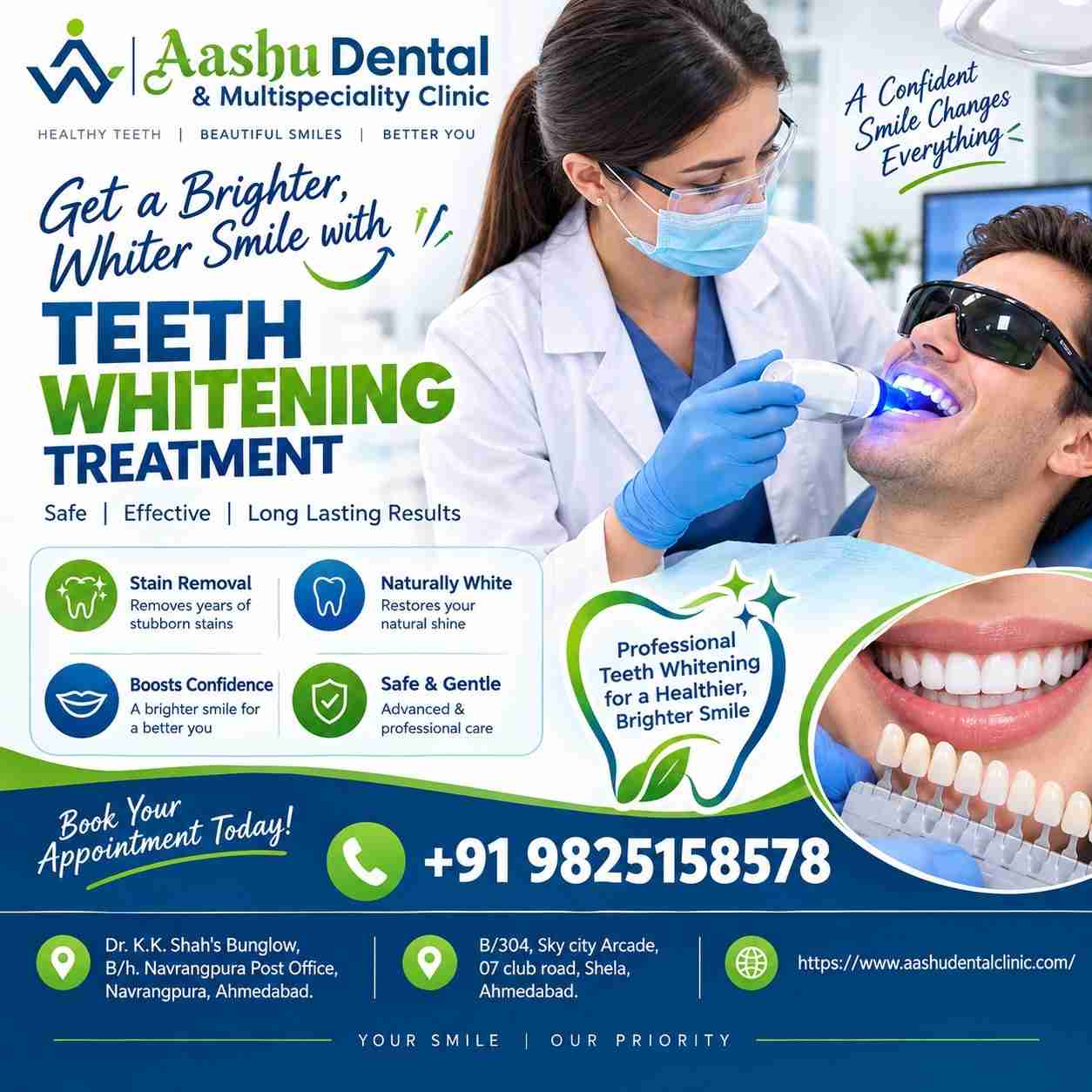 Expert Teeth Whitening Treatment for Yellow Stained Teeth